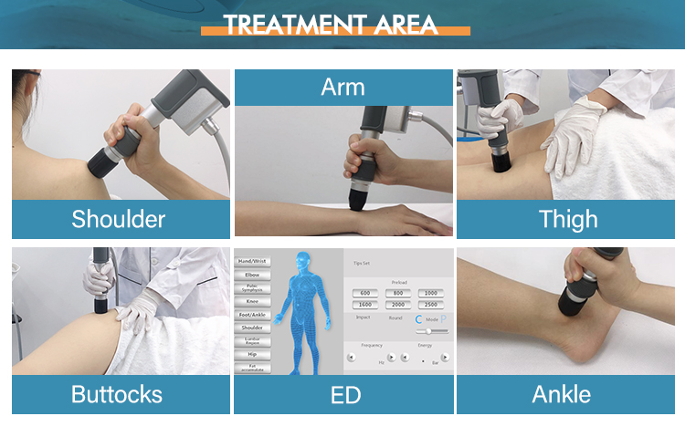 9 Things you didn't know about ESWT Shockwave Therapy — Shockwave