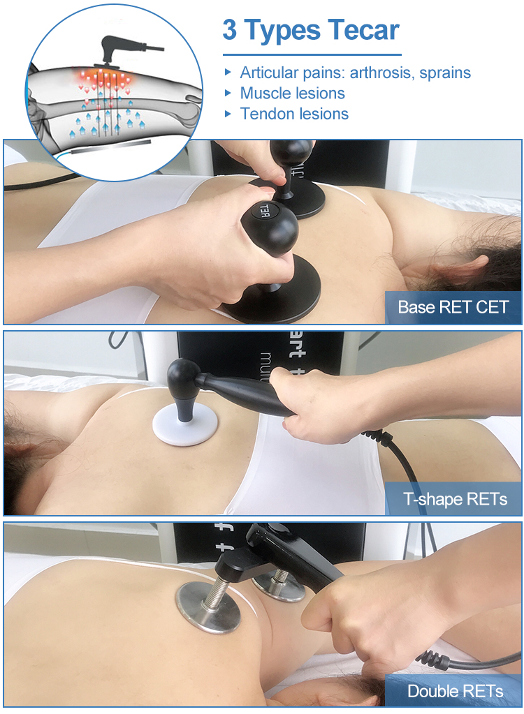 shockwave therapy machine