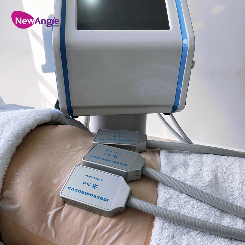 New Arrivals Portable Cryolipolysis