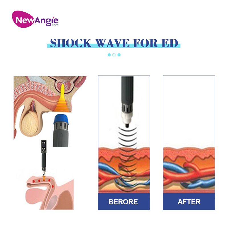 Shock Wave Machine for Sale 2 Digital Handles And 14pcs Treated Heads SW17