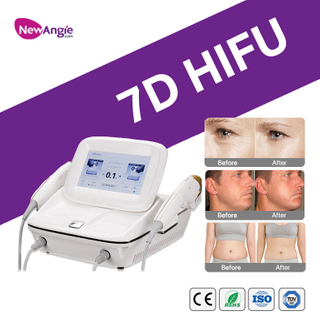 Hifu Facelift Apparaat Kopen