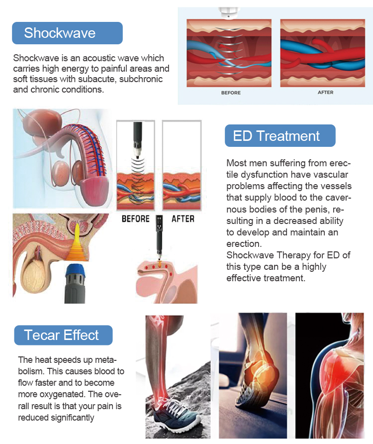 shockwave therapy machine