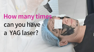 How Many Times Can You Have A YAG Laser?