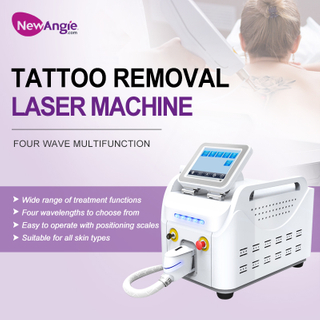Laser Tattoo Removal Equipment