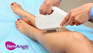 Laser hair removal has the advantage of hair removal is very thorough