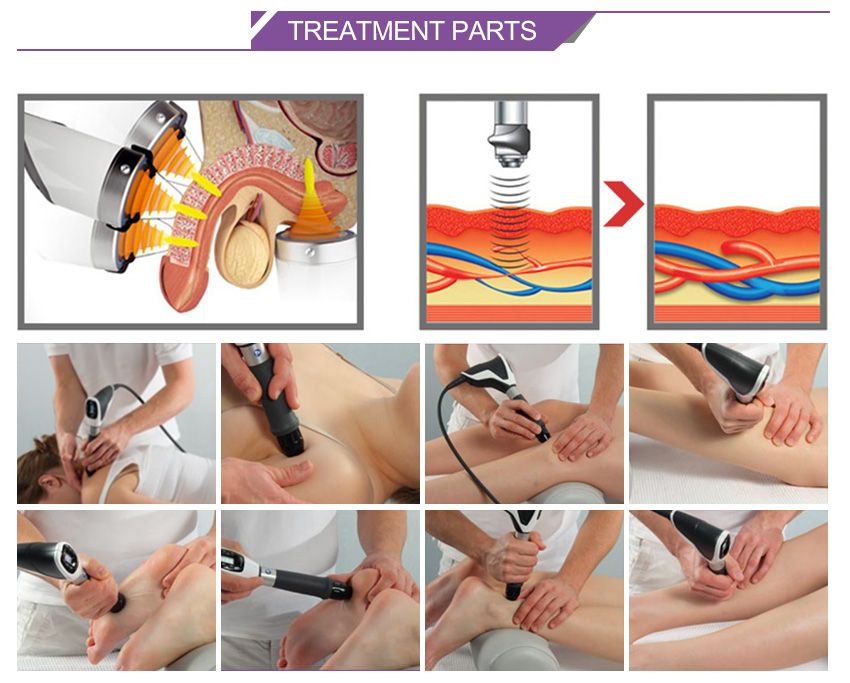 Low intensity Shock Wave Therapy Machine for Physiotherapy Center