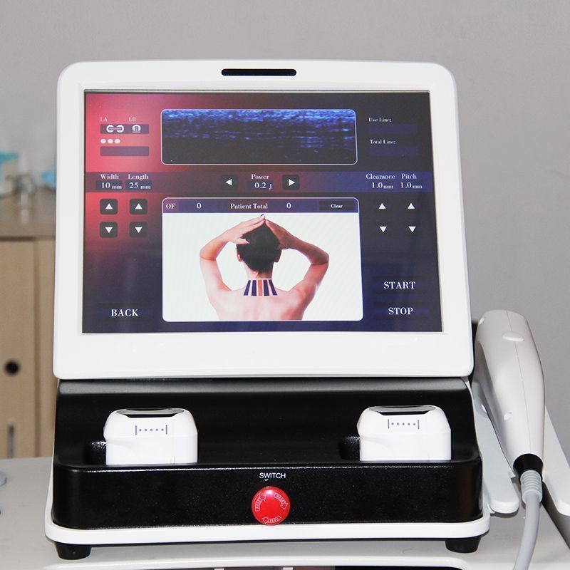 Laser Tattoo Removal Machine For Sale Philippines